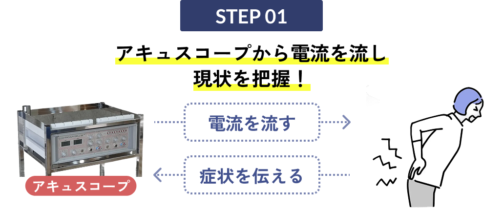 アキュスコープの仕組み